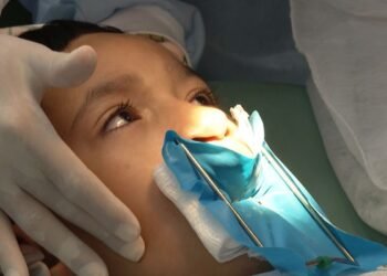 Genética e inflamação na gravidez explicam lábio leporino