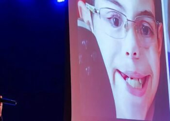 Dia de conscientização busca informar população sobre o lábio leporino