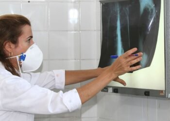 Governo cria comitê para reduzir casos de tuberculose até 2030