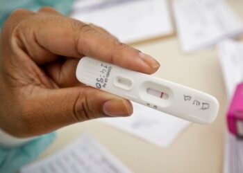 Positividade de testes de covid-19 subiu de 4% para 13%, diz UFRJ