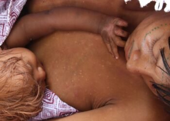 Pediatras pedem atenção para a saúde de crianças e jovens indígenas