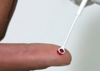 Prefeitura do Rio amplia acesso à profilaxia ao HIV