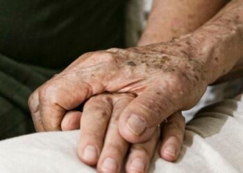 Falta de diagnósticos para Alzheimer preocupa especialistas