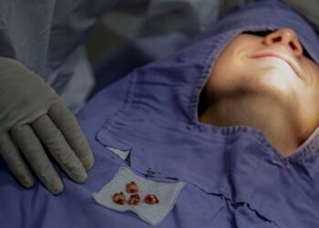 Brasil Sorridente deverá cobrir 62,5% da população em 2024