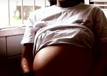 Mortes maternas de negras são mais que o dobro que de brancas