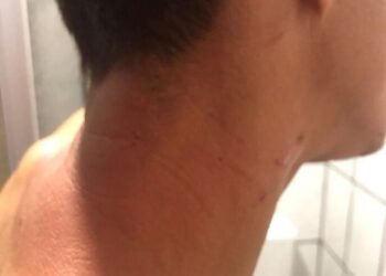 Repercute suposta agressão de vereador e advogado a jovem que foi pedir ajuda na Bahia