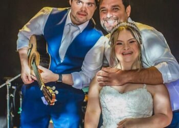 Artistas com Down contrariam previsões e viram inspirações