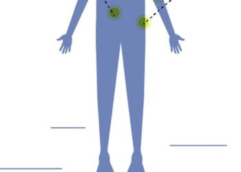 Pacientes com neuroblastoma aguardam inclusão de medicamento no SUS