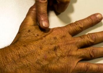 Inca manifesta apoio a imposto seletivo sobre bebidas alcoólicas