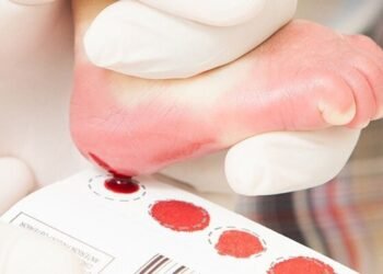 Associações assinam manifesto pela ampliação do teste do pezinho