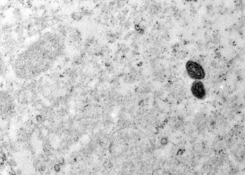 Argentina descarta mpox em tripulante de navio que saiu do Brasil