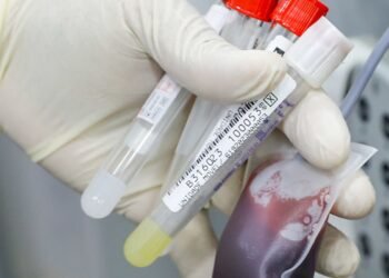 Teste rápido na detecção da febre bubônica é avaliado em campo