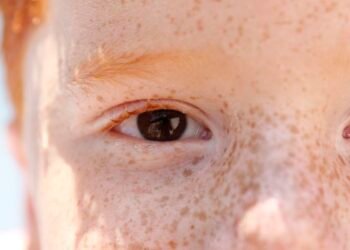 Campanha de conscientização sobre retinoblastoma começa hoje