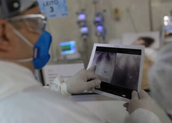 Internações por doenças respiratórias aumentam quase 28%