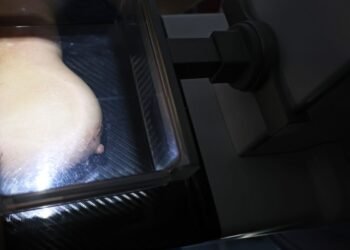 Mulheres de baixa renda terão exames gratuitos de câncer de mama