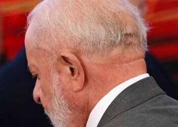 Lula vai a hospital e retira pontos de corte após queda