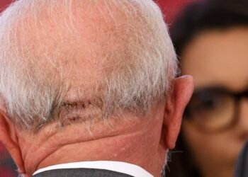 Lula faz exames em Brasília e apresenta quadro estável