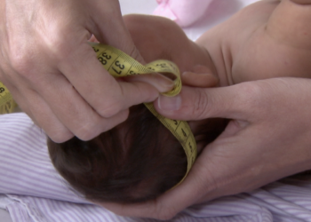 Governo pagará R$ 60 mil a famílias de crianças afetadas pelo Zika