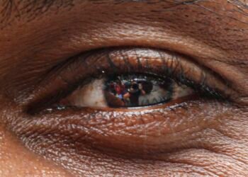 Pessoas desconhecem riscos ao escanear a íris, alertam especialistas