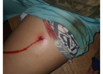 Novo ataque no Paraná deixa mais quatro indígenas feridos