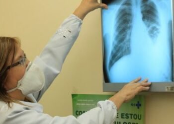 Brasil está na contramão da meta da OMS para extinção da tuberculose