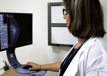 Entidades médicas pedem faixa etária maior para mamografia de rastreio
