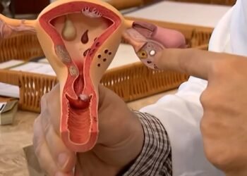 Endometriose: conheça os sintomas e saiba como tratar a doença