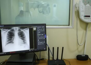 Brasil tem aumento de hospitalizações por Influenza A, alerta Fiocruz