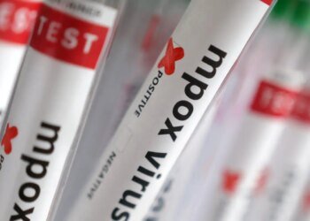 Região Norte do Brasil registra casos de mpox