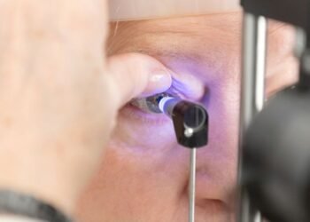 Saúde quer padronizar abordagem para eliminação do tracoma no Brasil