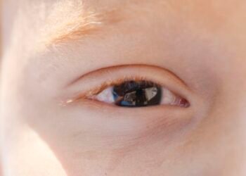 Cartilha sobre saúde ocular na infância orienta pais e professores