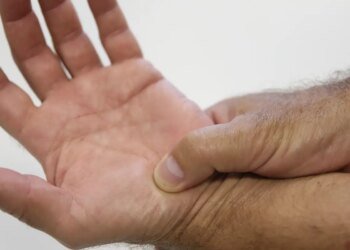 Política para pacientes reumáticos pode criar modelo a ser replicado