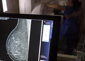 Falta de acesso a mamógrafos limita prevenção do câncer de mama