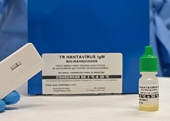 Novo teste faz diagnóstico de hantavirose em 20 minutos