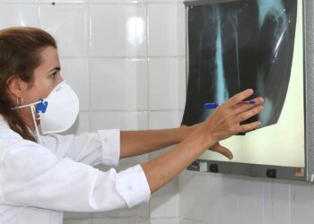 OMS recomenda testes de diagnóstico rápido para erradicar tuberculose